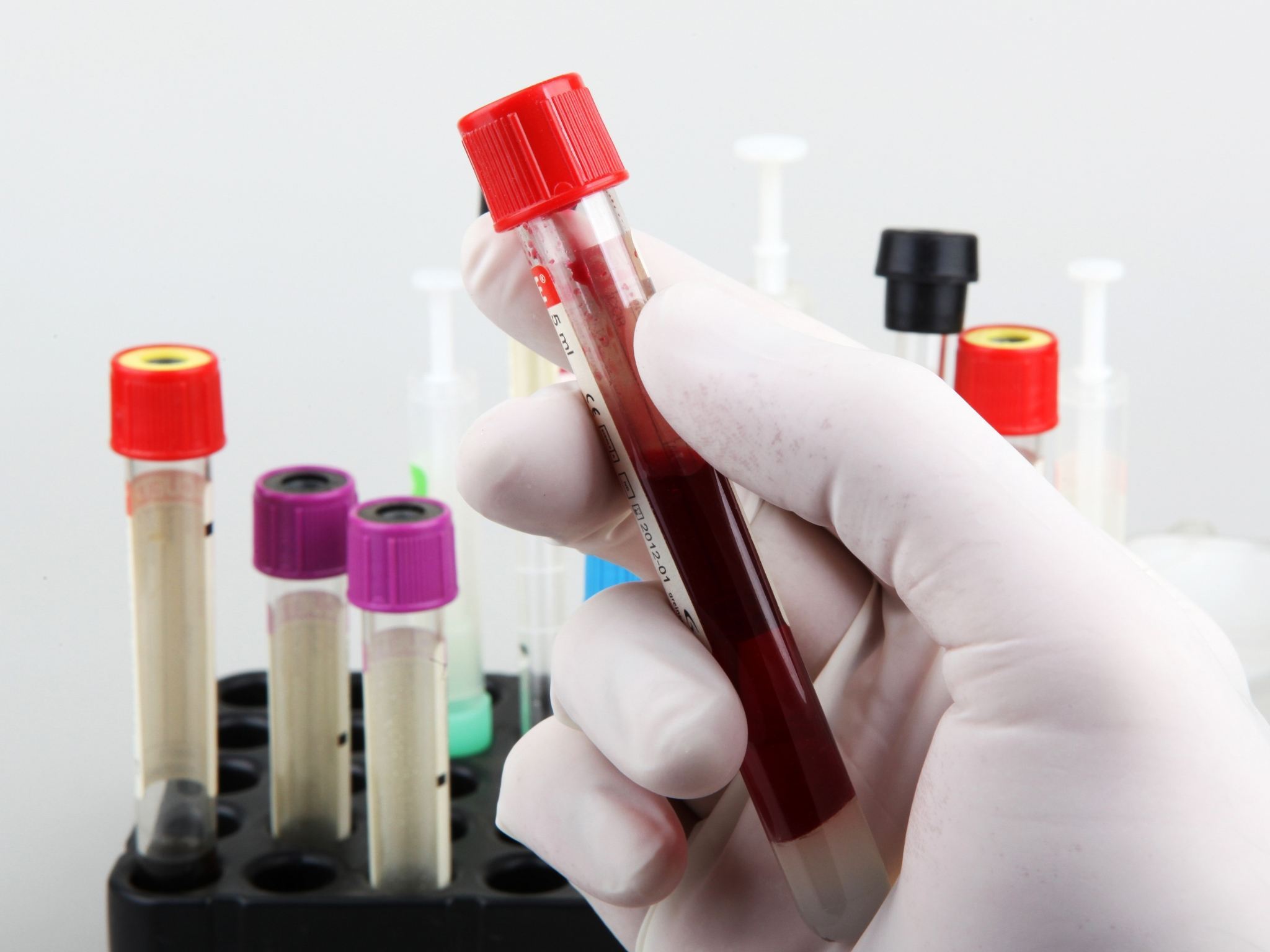 analisi-ormonali-tiroide-perugia