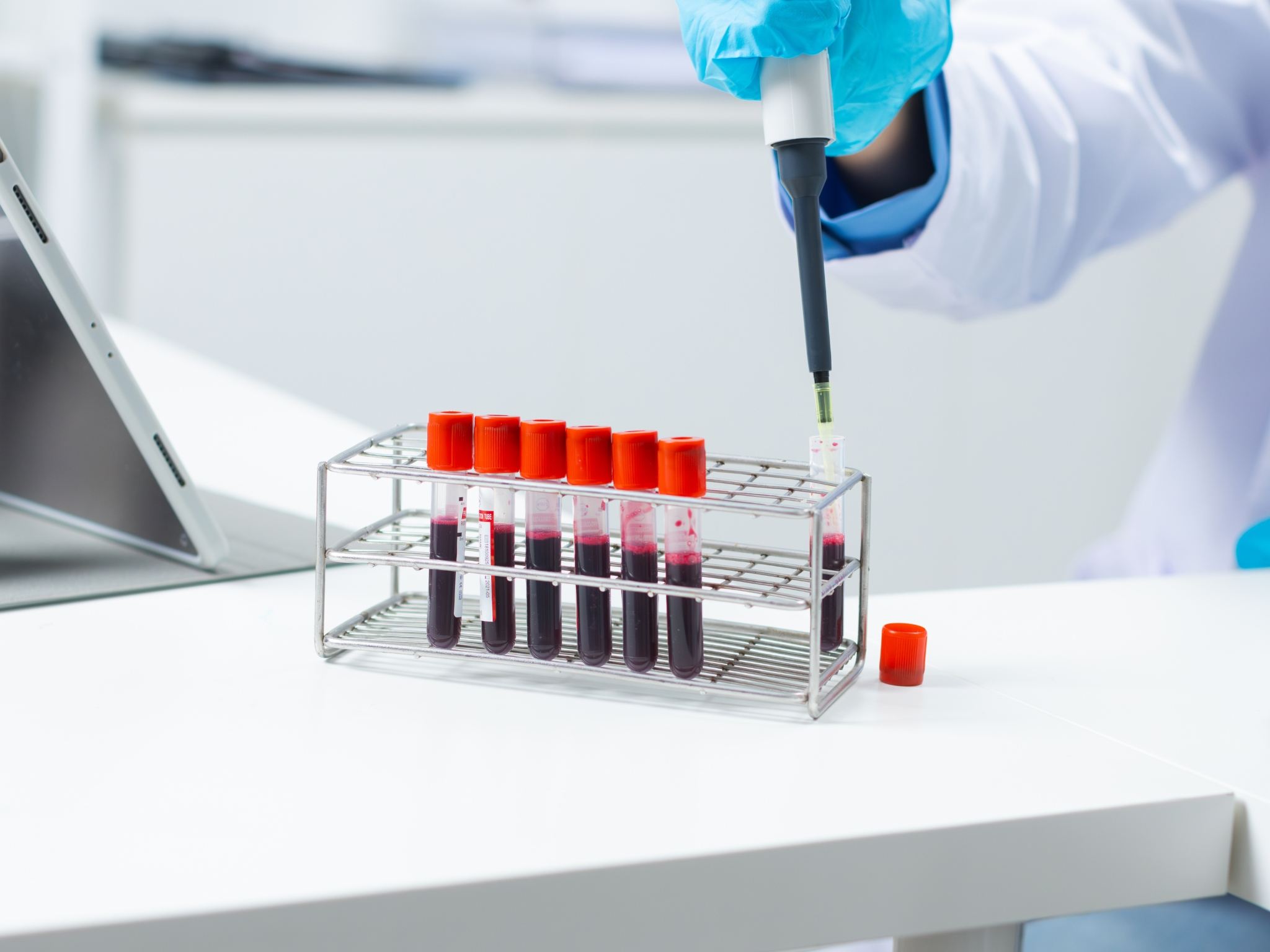 Laboratorio di analisi a Perugia presso gli Studi Medici San Nicolò per il dosaggio delle IgE e test allergometrici avanzati per visita dall'allergologo a Perugia.