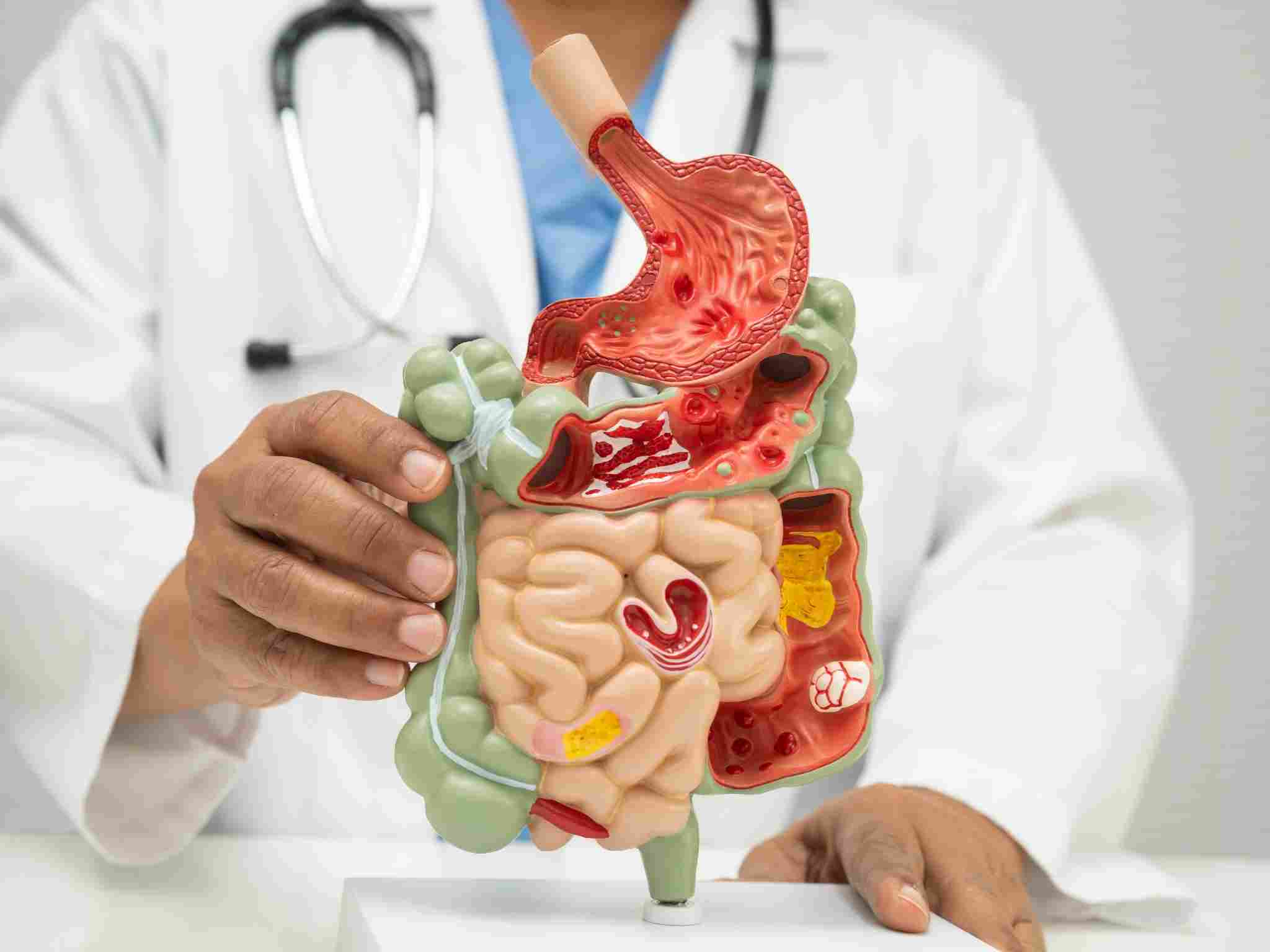 Organi trattati dallo specialista in gastroenterologia a Perugia.