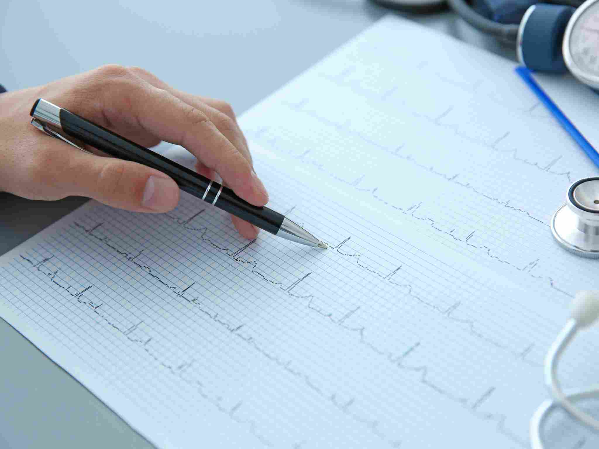 Tracciato elettrocardiografico per il controllo del ritmo cardiaco e diagnosi di aritmie.