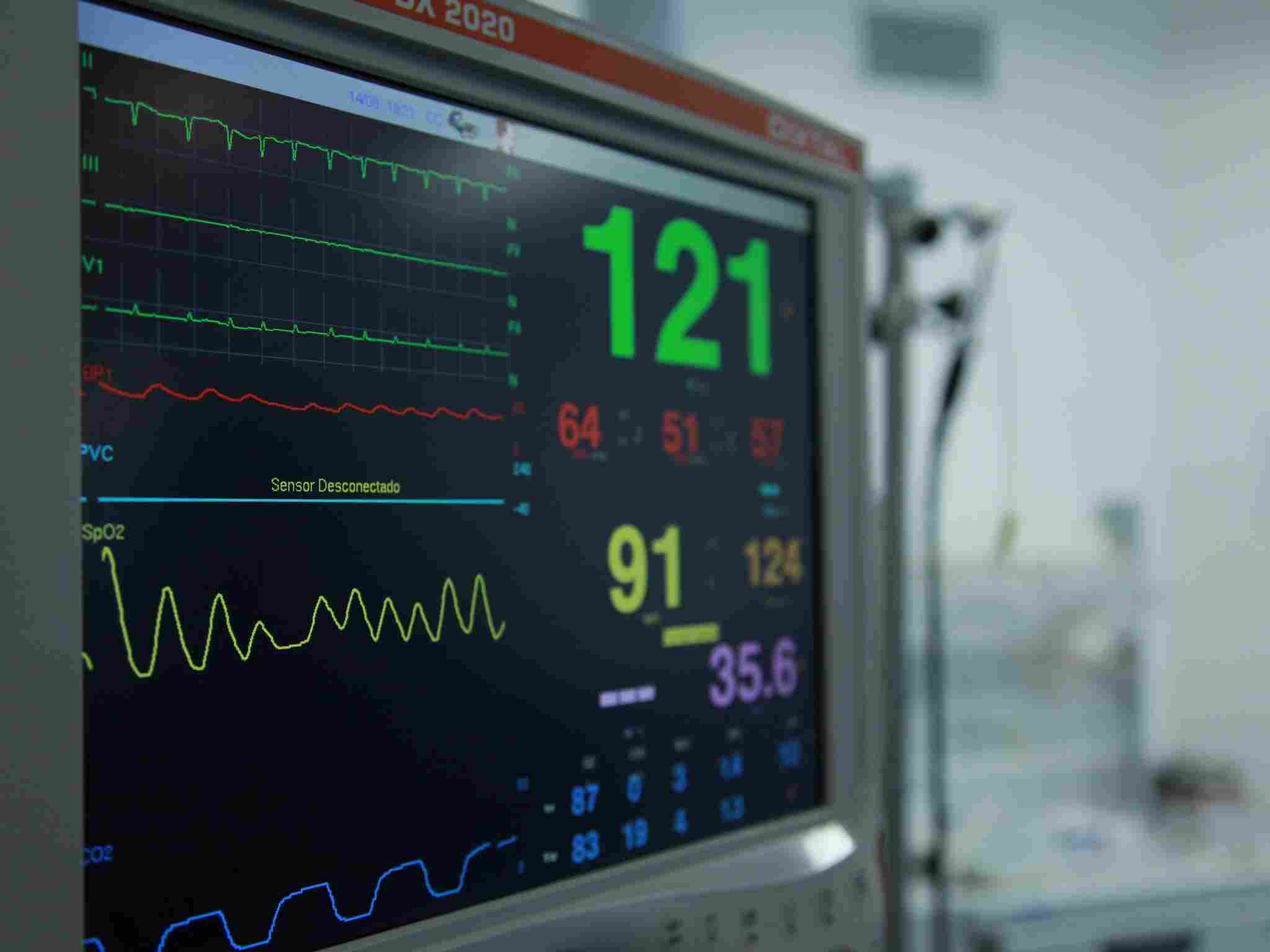 Tracciato elettrocardiografico per il controllo del ritmo cardiaco e diagnosi di aritmie.