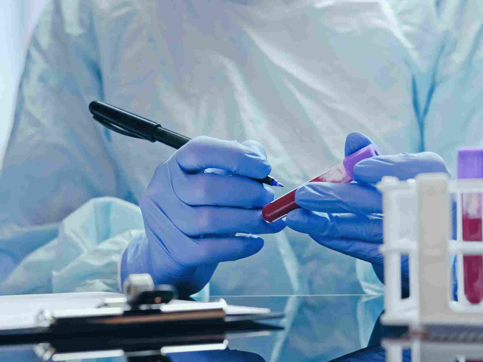 Analisi cliniche e test per celiachia e intolleranze a Perugia.