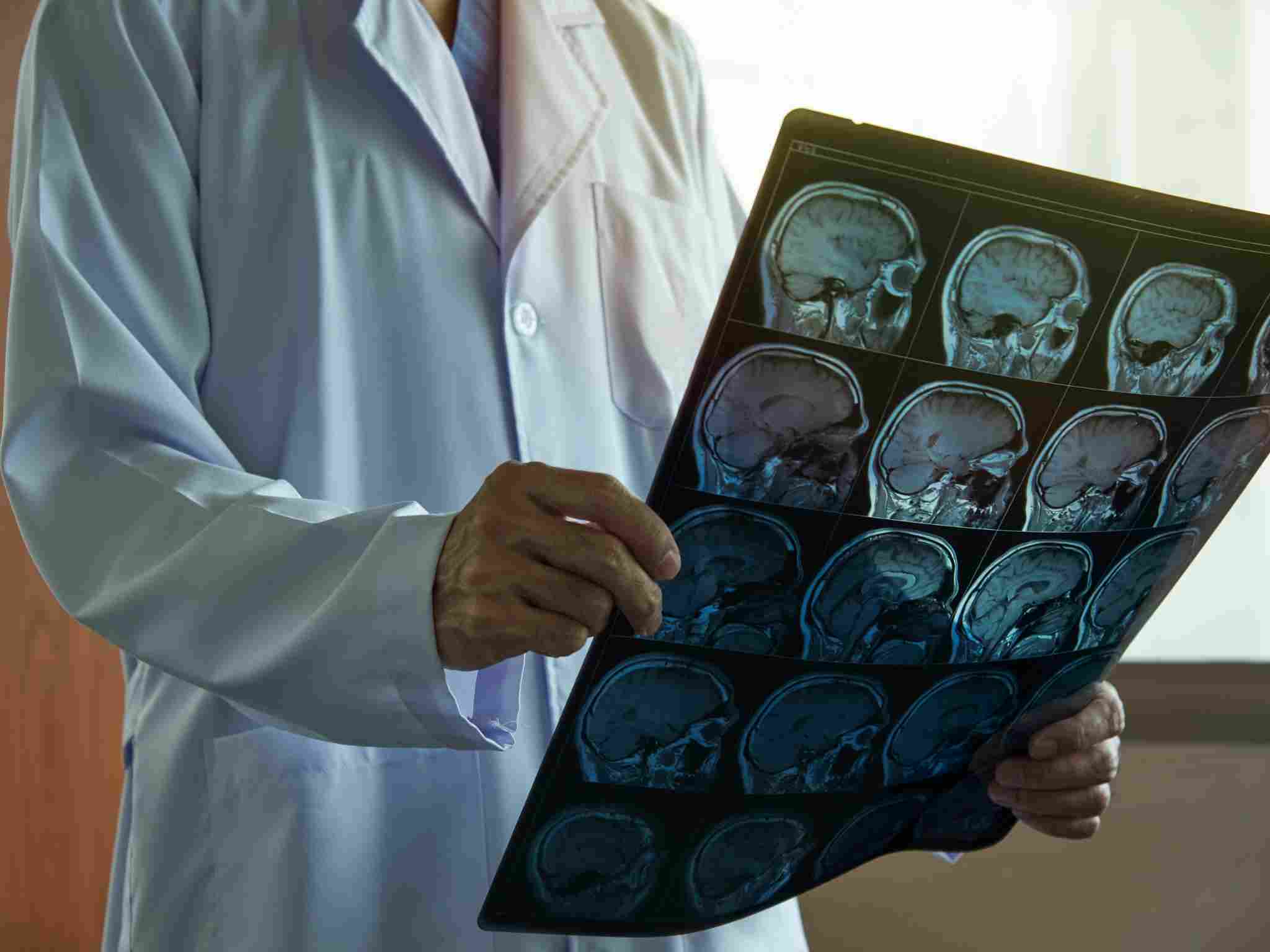 Neurologo a Perugia per diagnosi e cura di malattie neurologiche a Perugia come Parkinson, Alzheimer, epilessia e cefalee.