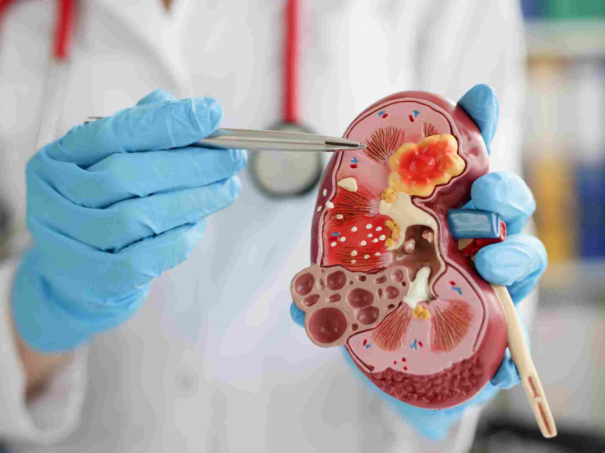 Diagnosi di patologie urologiche a Perugia: iperplasia prostatica, calcolosi urinaria e incontinenza.