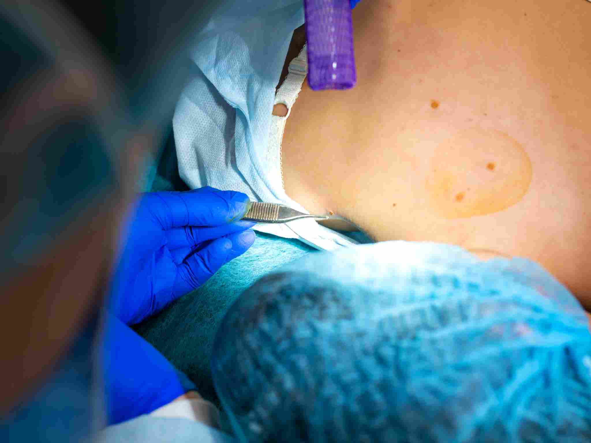 Sala per interventi di piccola chirurgia ambulatoriale e asportazione lesioni cutanee a Perugia.