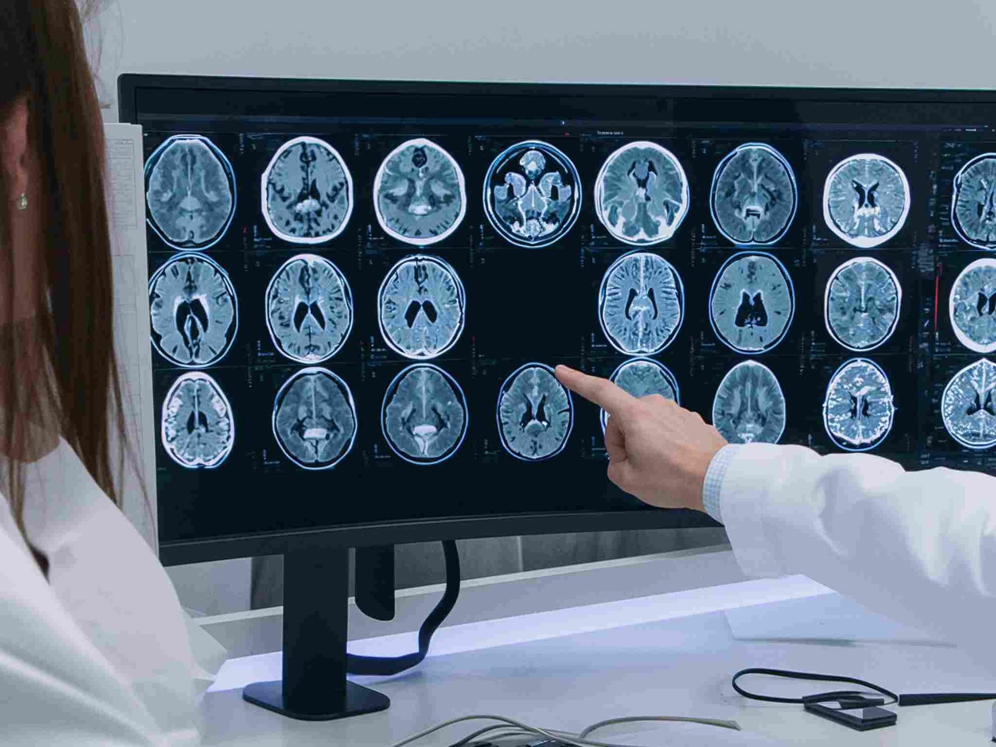 Consulto con il neurologo a Perugia per la diagnosi di patologie del sistema nervoso centrale e periferico.